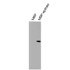 Western blot validation of Anti-TRα Recombinant Monoclonal Antibody using recombinant MBP-epitope fusion protein.