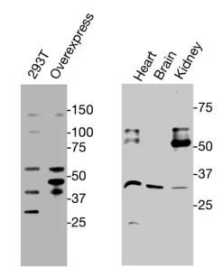 Western blot showing endogenous TRα detected in HEK293T overexpression cells and mouse tissues using XM0001.