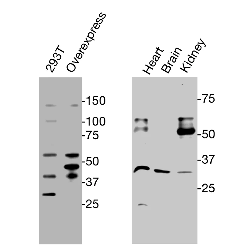 Western blot showing endogenous TRα detected in HEK293T overexpression cells and mouse tissues using XM0001.