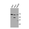Western blot detection of endogenous OPRL1 in HEK293T, HeLa, and HepG2 cells using Anti-human OPRL1 Recombinant Monoclonal Antibody.