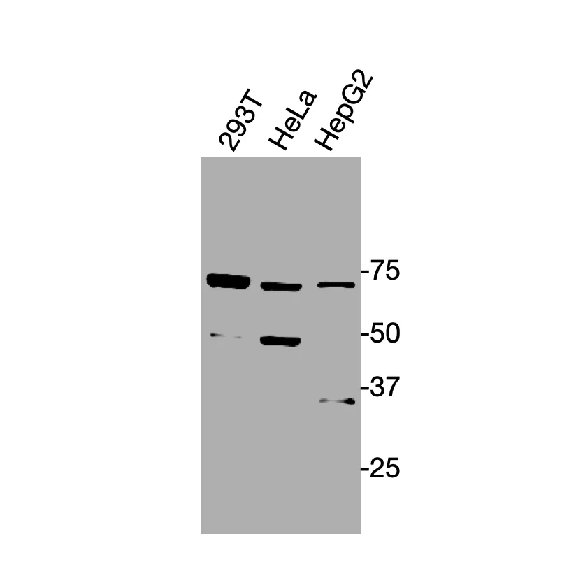Western blot detection of endogenous OPRL1 in HEK293T, HeLa, and HepG2 cells using Anti-human OPRL1 Recombinant Monoclonal Antibody.