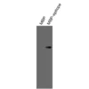 Western blot validation of Anti-human PTGER3 Recombinant Monoclonal Antibody using recombinant MBP-epitope fusion protein.